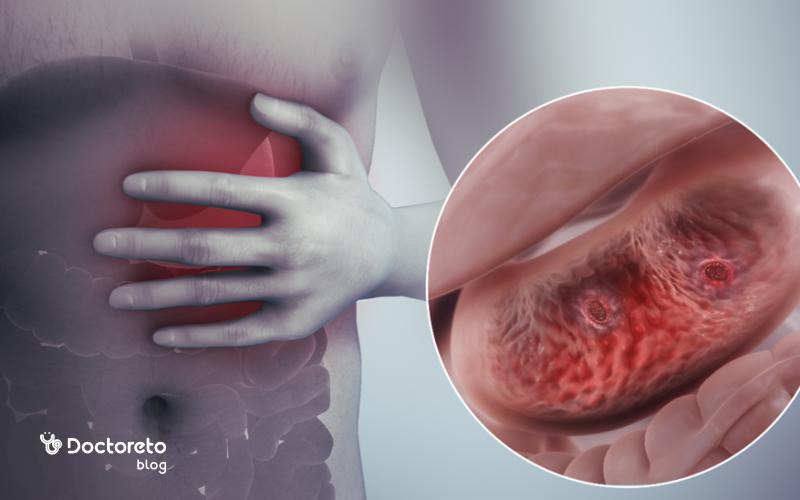 خونریزی گوارشی چه زمانی اورژانسی است؟