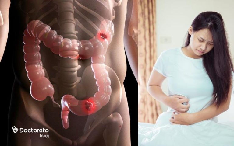 بررسی تمامی بیماریهای دستگاه گوارش و میزان خطرناک بودن آنها
