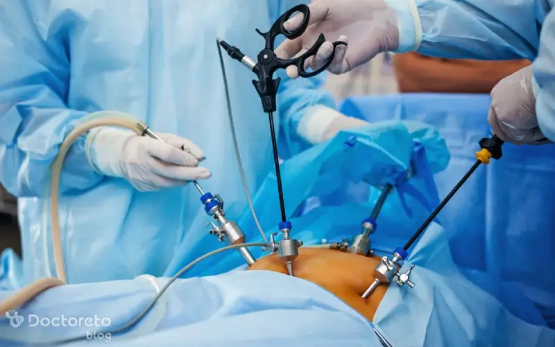 باز کردن لوله رحم بعد از بستن