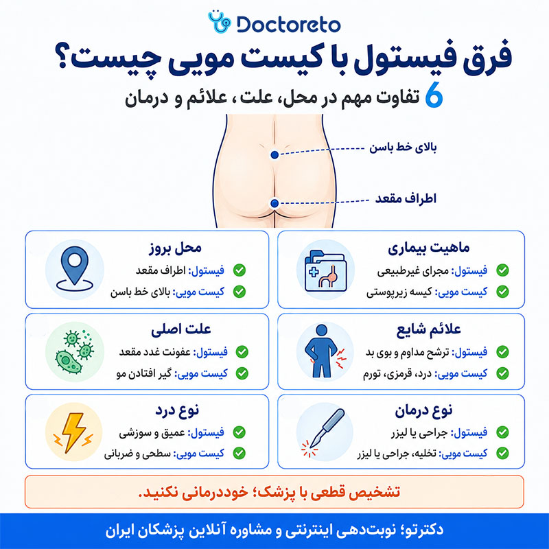 اینفوگرافی فرق فیستول با کیست مویی