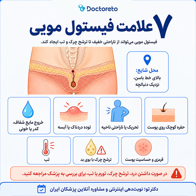 اینفوگرافی فیستول مویی چیست