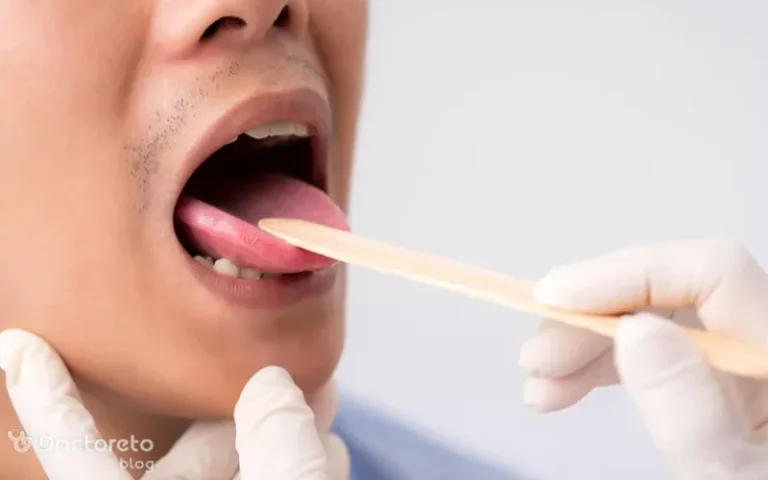 علائم لوزه چیست؟ بررسی نشانه های عمومی تا ظاهری