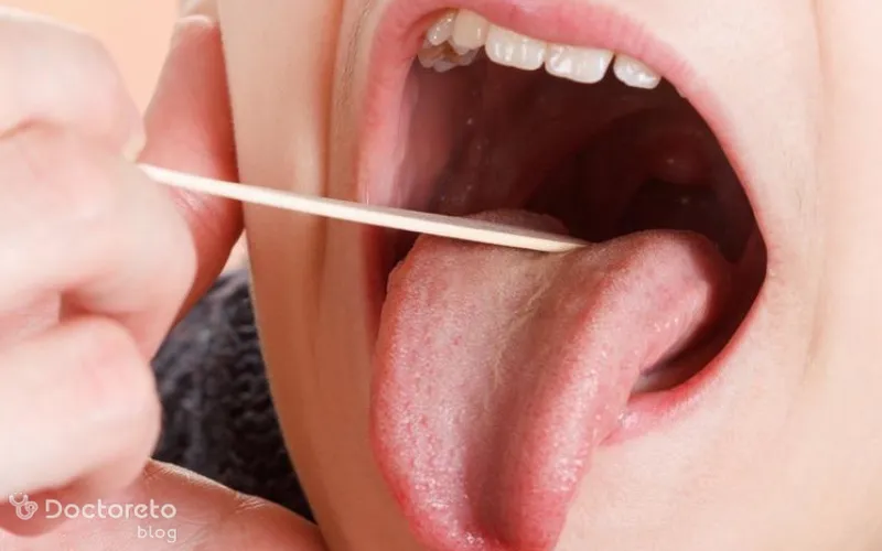 نشانه های لوزه چیست؟