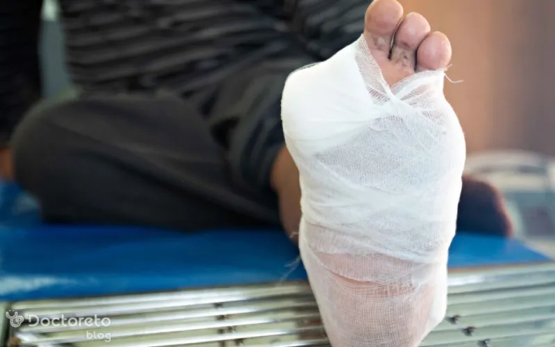 راهنمای مراقبت از زخم پای دیابتی به همراه تمام اصول و راهکارها