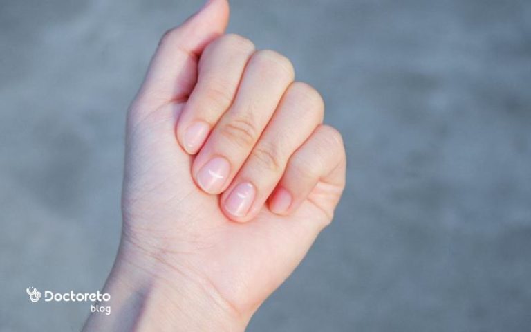 بررسی علل لکه روی ناخن و راه های درمان آن