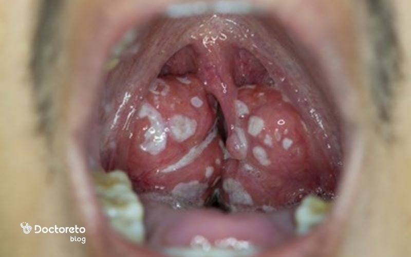 رنگ و بافت سنگ لوزه در عکس چگونه است؟