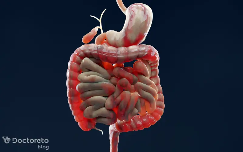 تفاوت خونریزی گوارشی تحتانی با خونریزی گوارشی فوقانی در چیست؟