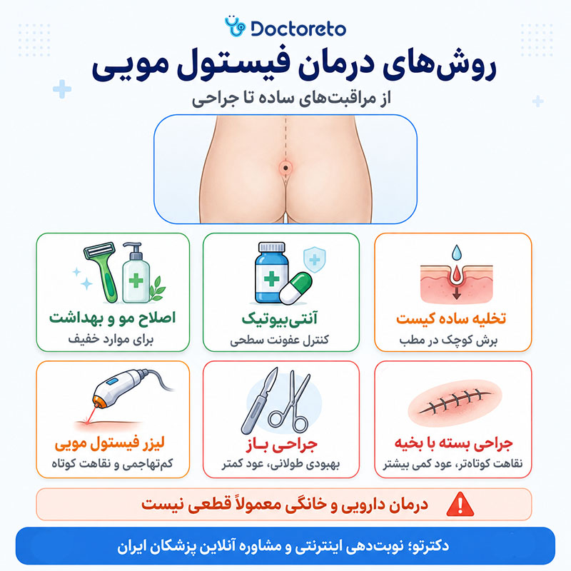 اینفوگرافی درمان فیستول مویی