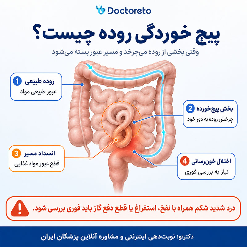 اینفوگرافی پیچ خوردگی روده چیست