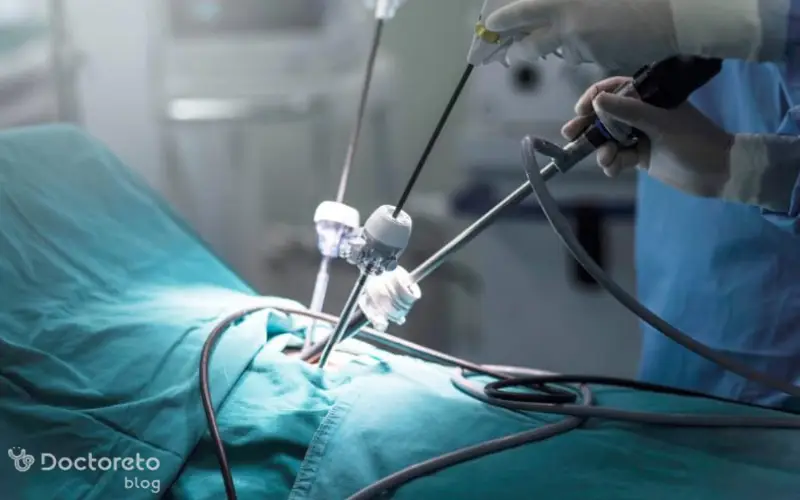 بستن لوله رحم با لیزر تا چه اندازه کارآمد است؟