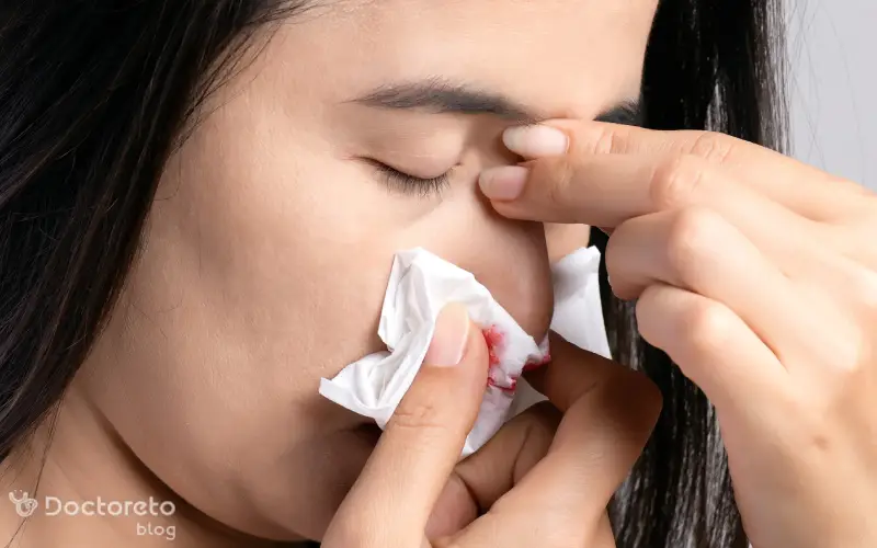 علت خون دماغ شدن از سوراخ چپ بینی چیست؟