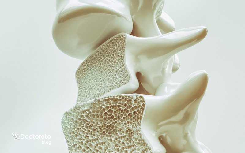 علائم پوکی استخوان چیست؟