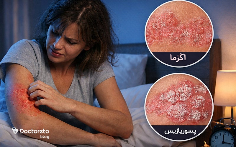 علت خارش بدن در شب همراه با ضایعه پوستی چیست؟