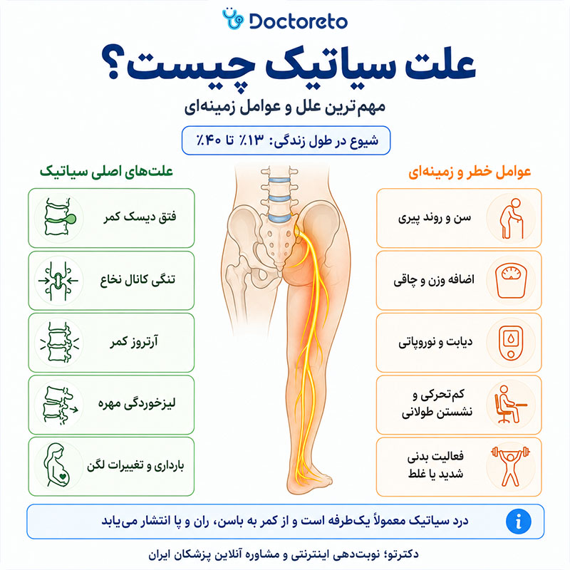 اینفوگرافی علت سیاتیک