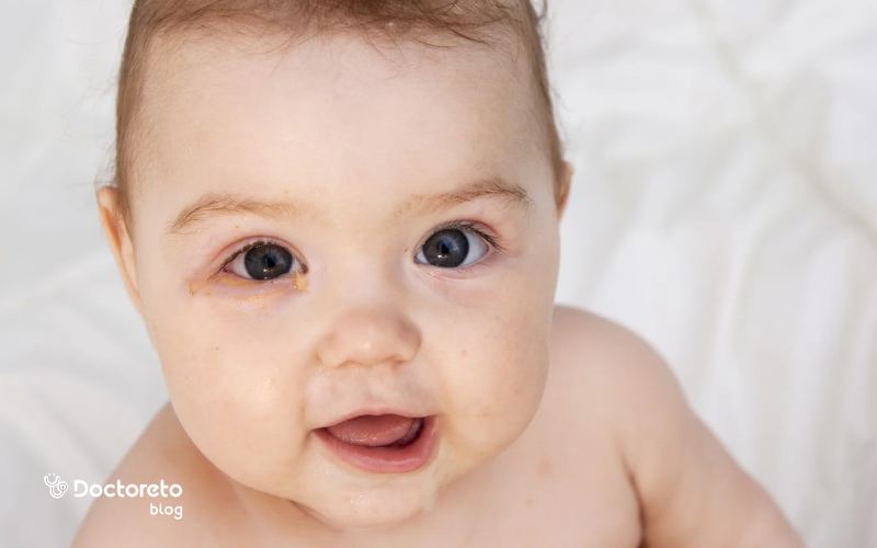 چه زمانی عفونت چشم کودک نیاز به مراجعه به پزشک دارد؟