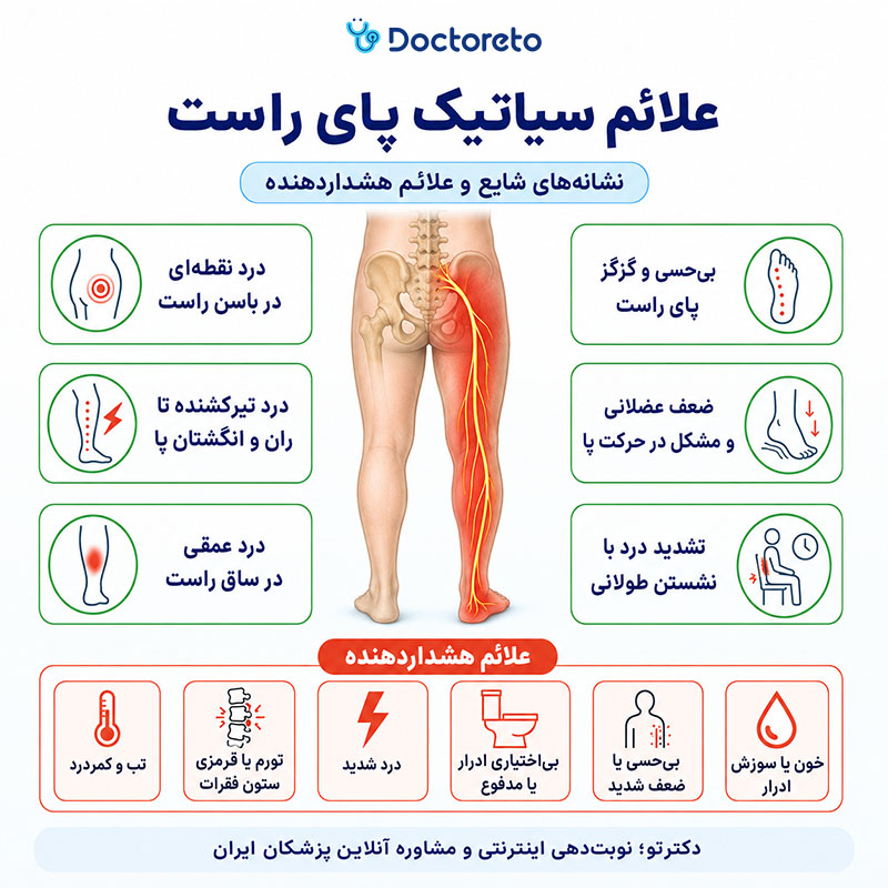 اینفوگرافی علائم سیاتیک پای راست