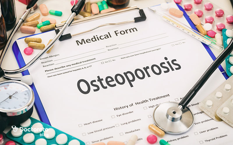 درمان دارویی پوکی استخوان چگونه است؟