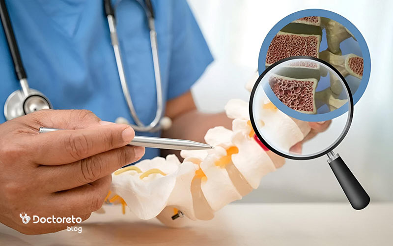 علائم مخفی پوکی استخوان چیست؟