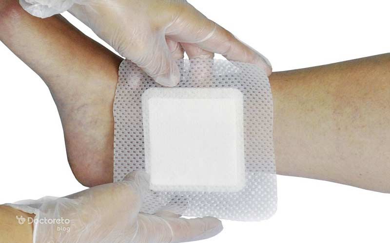 اصول مهم پانسمان زخم پای دیابتی شامل چه مواردی است؟