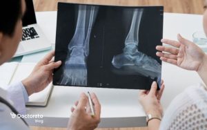 عکس روماتیسم پا چه مواردی را نشان می دهد؟
