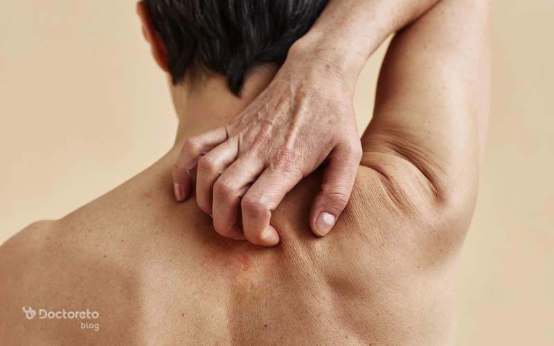 آیا اسکلرودرمی باعث مرگ میشود؟