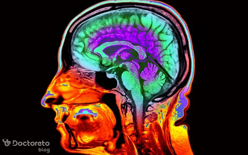 عکس نوار مغز تشنجی چگونه است؟