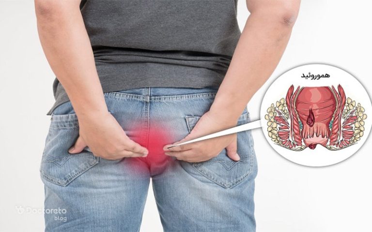بهترین آنتی بیوتیک برای عفونت مقعدی چیست؟