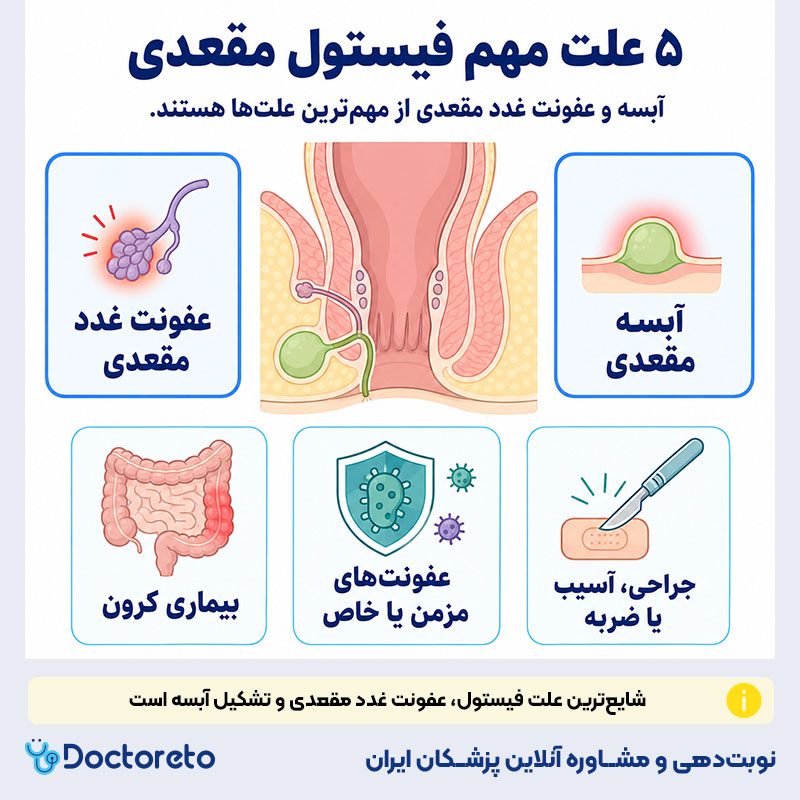 اینفوگرافی علت بوجود آمدن فیستول مقعدی