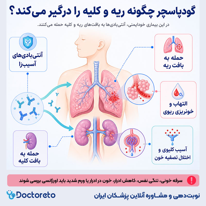 اینفوگرافیک سندروم گودپاسچر