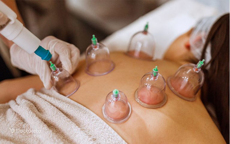 خون لخته در حجامت نشانه چیست و چه خطراتی دارد؟