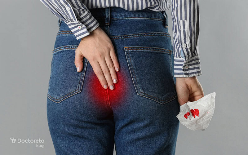 آیا چاقی عاملی برای بواسیر در زنان است؟