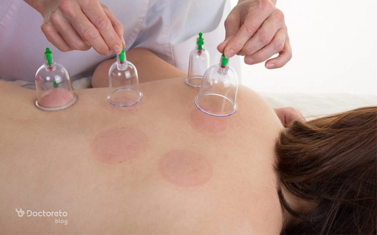 حجامت بهتر است یا خون دادن؟ مقایسه فواید و خطرات این دو روش