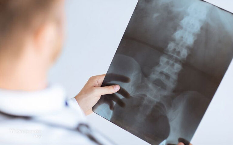 چگونه بفهمیم تنگی کانال نخاع داریم؟