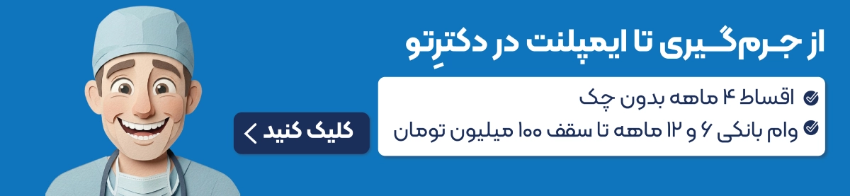 طرح اقساطی ایمپلنت دندانپزشکی دکتریتو