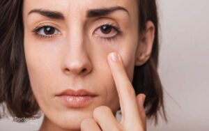 آلرژی چشمی و هر آنچه باید در مورد آن بدانید