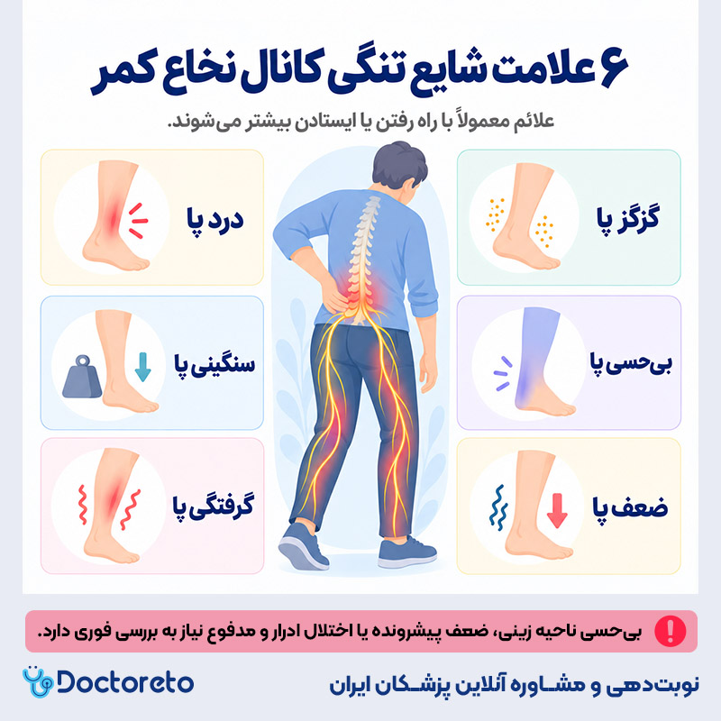 اینفوگرافی تنگی کانال نخاع کمر