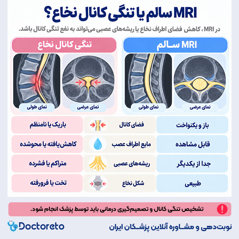 اینفوگرافیک عکس ام ار ی تنگی کانال نخاع