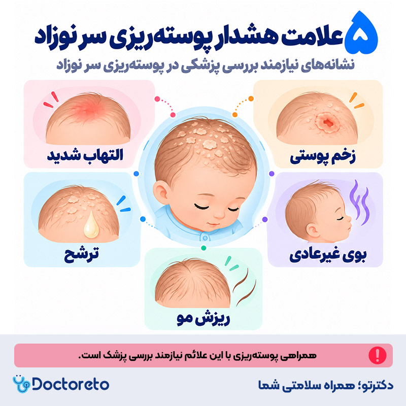 اینفوگرافی پوسته ریزی سر نوزاد