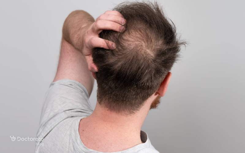 شامپو ضد ریزش آقایان را چند بار در هفته استفاده کنیم؟