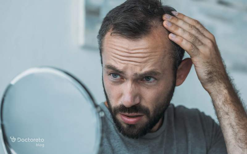بهترین شامپو برای ریزش مو در آقایان کدام است؟