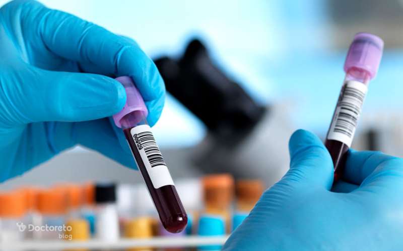 چرا آزمایش هورمونی در روز دوم یا سوم پریودی انجام میشود؟