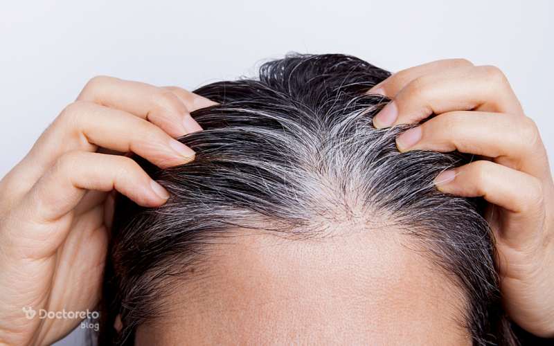 کدام فاکتورها برای ریزش مو هورمونی در زنان باید چک شود؟
