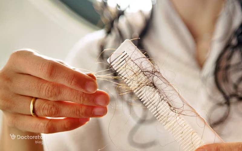 آزمایش هورمون تیروئید برای ریزش مو شامل کدام فاکتورها است؟