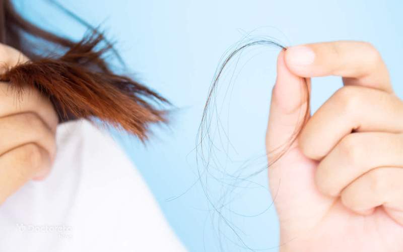 کدام هورمون‌ها باید برای ریزش مو چک شوند؟