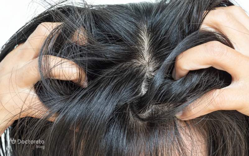 آیا خشکی و آلرژی پوست سر باعث خارش و ریزش مو می‌شود؟