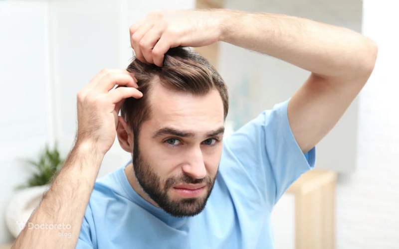 خارش سر و ریزش مو نشانه کمبود چه ویتامینی است؟