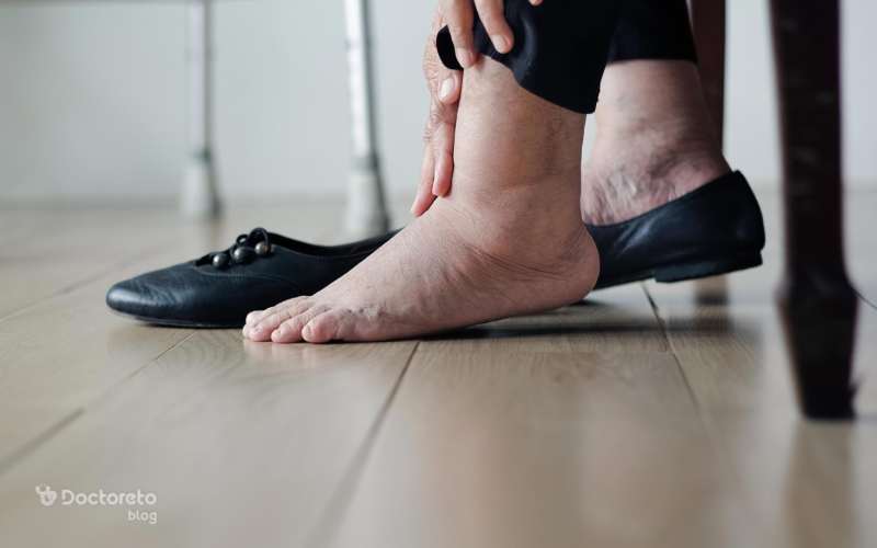 بهترین قرص برای ورم پا کدام است؟