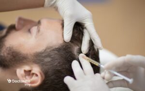 علت ریزش مو بعد از پی ار پی چیست؟