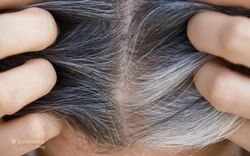 کدام سرطان باعث ریزش مو میشود؟