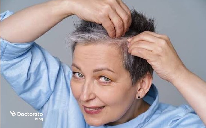 علت ریزش مو در زنان بالای ۴۰ سال چیست؟